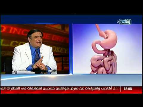 الناس الحلوة أنواع السمنة وفنيات اختيار الجراحة المناسبة مع دكتور ياسر عبد الرحيم