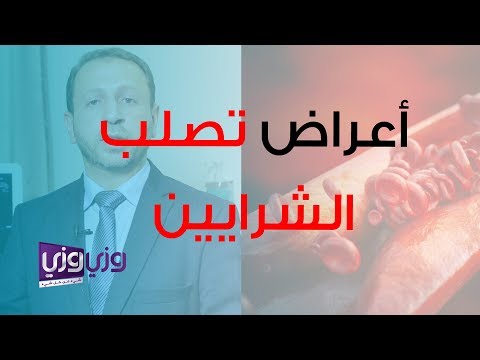 فيديو: لماذا يؤدي تصلب الشرايين إلى نوبة قلبية؟