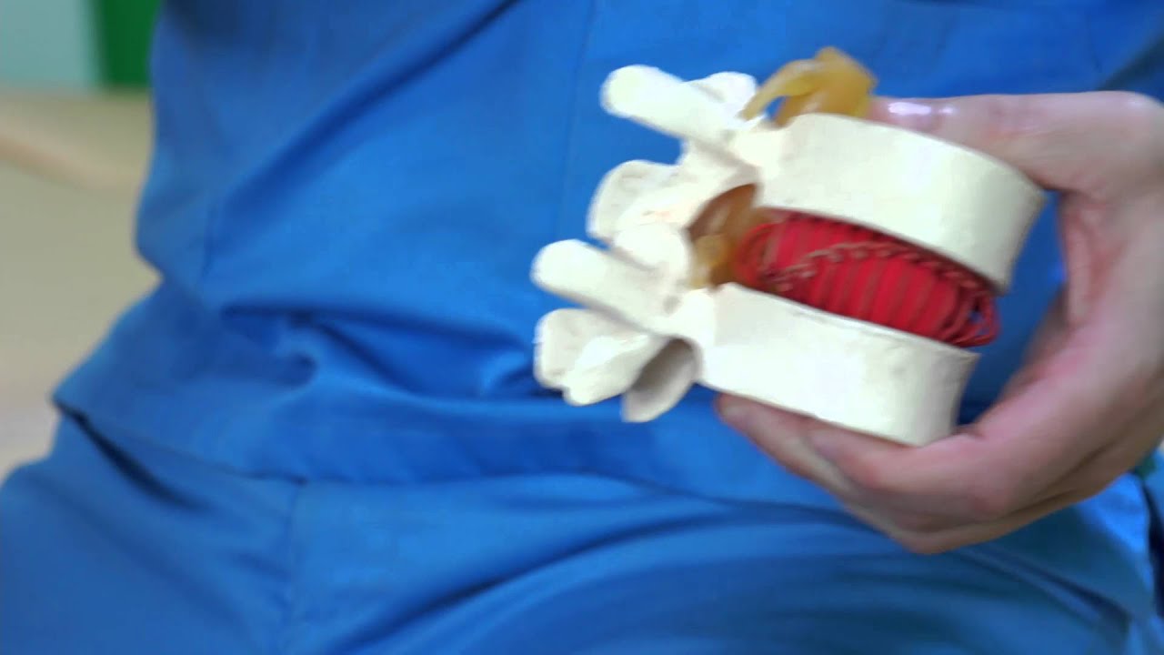 infantile systemic hyalinosis ¿Cómo se produce una hernia discal? - Fisioterapia Bilbao