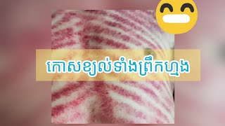 ខ្យល់ចាប់ទាំងព្រឹកហ្មង sick in the morning