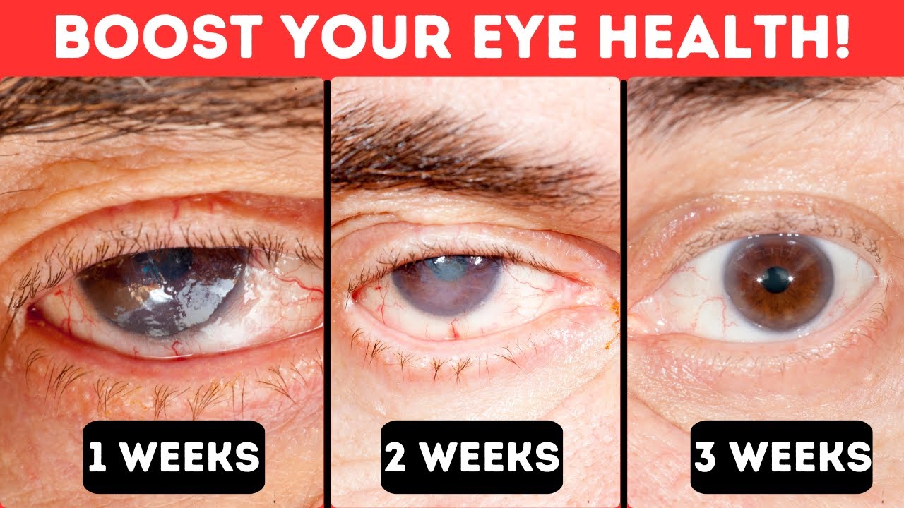 9 TOP Foods To Help Improve Your Eye Health Naturally!