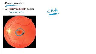 Video 219: Common Refractive Errors & Retinal Pathologies: Clinical Presentations & Diagnosis