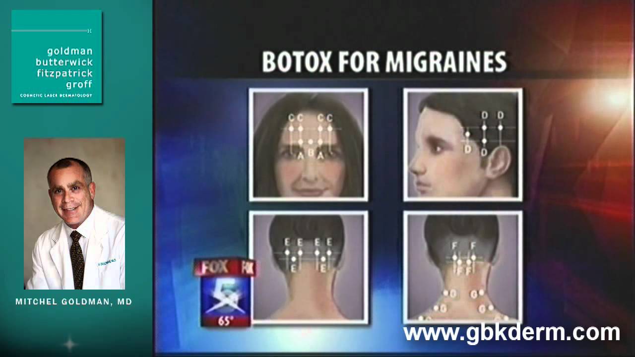 Banner for San Diego Dermatologist Dr Goldman on Migraine Headaches