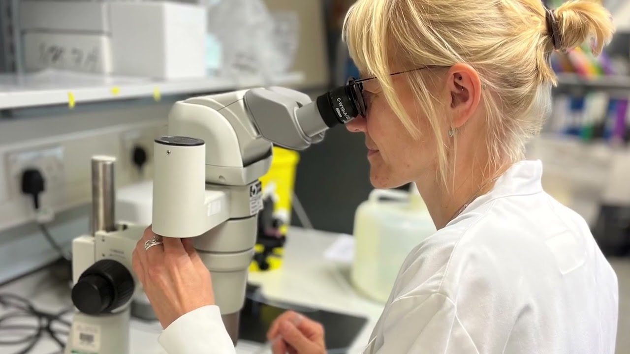 Misdirected intact TREX1 exonuclease activity causes human cerebral & systemic small vessel disease