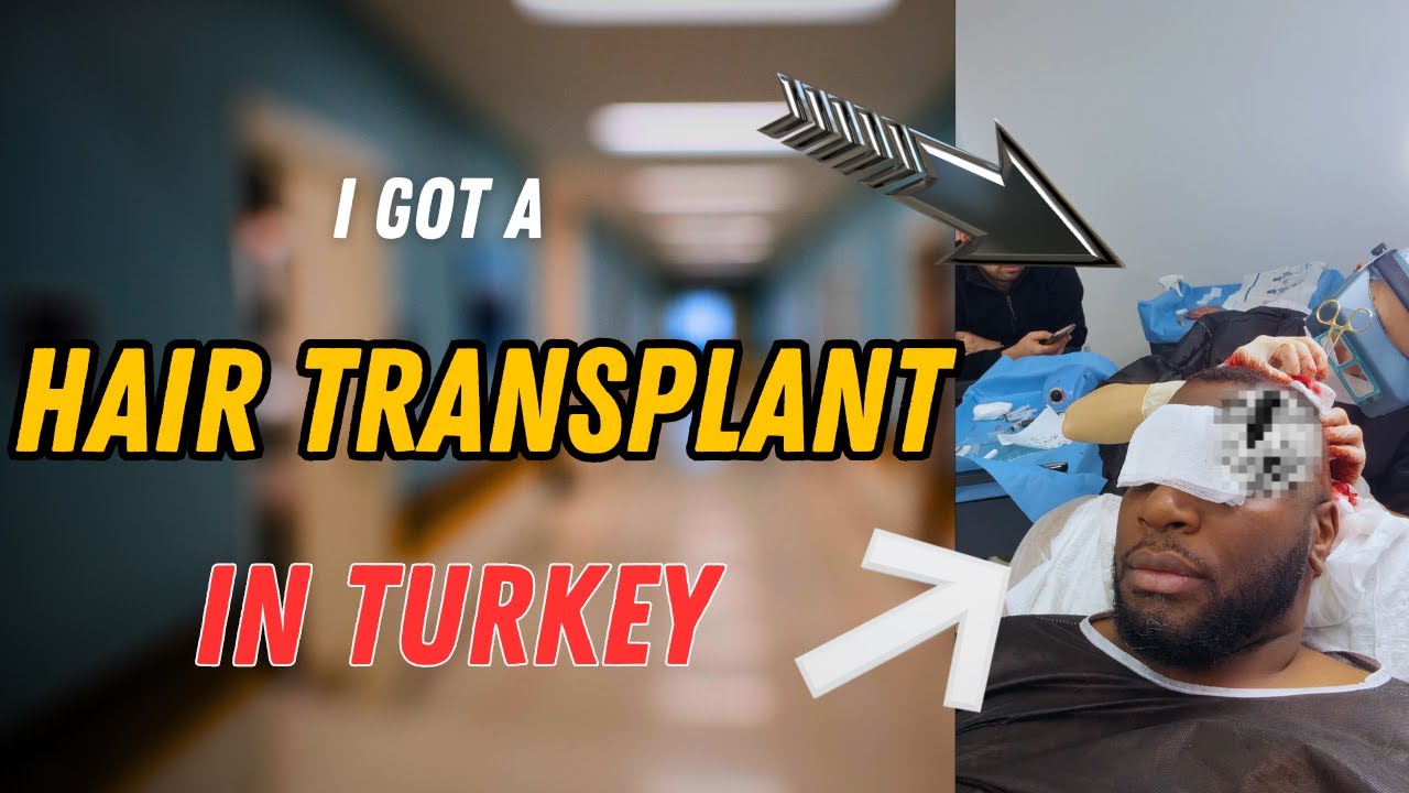 Hair Transplant at Heva Clinic Process | Turkey