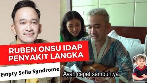Gejala Penyakit Langka yang Diidap Ruben Onsu