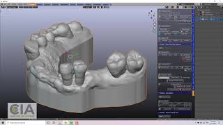 B4D model designer basics: 10-extracting isolated teeth