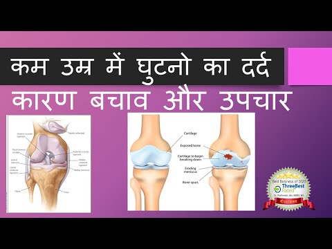 कम उम्र में घुटनो का दर्द:कारण बचाव और उपचार Young Painful Knee:Complete Treatment:#Chondromalacia