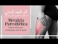 الم وحرقان الفخذ من الامام والخارج ألم الفخذ المذلي ألم العصب الفخذي الجلدي الوحشي