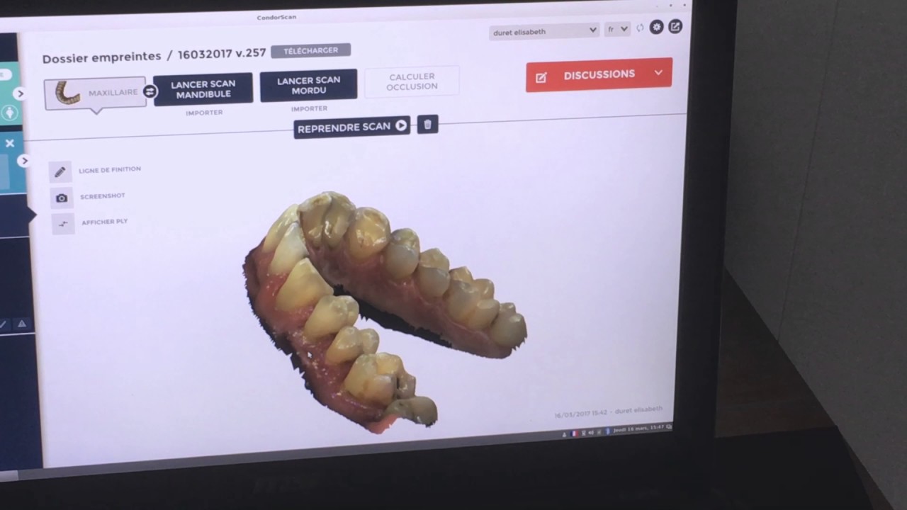 Full arch scan result