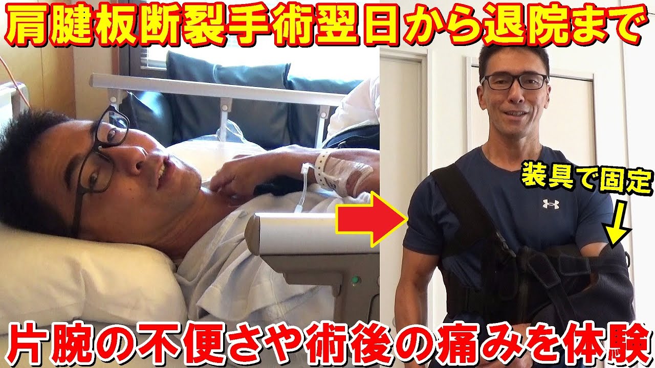 肩腱板断裂手術の翌日から片腕が使えない不便さや術後の痛みを体験して退院するまでの記録動画