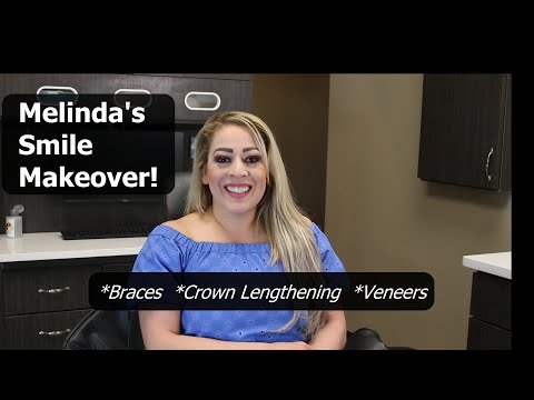 Video: Dapatkah pemanjangan mahkota dilakukan dengan kawat gigi?