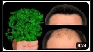 🔥Hair grows like crazy and doesn't fall out! A powerful remedy! Strongest Ingredients