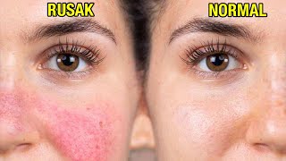 Kenali Tanda Skin Barrier Rusak, Jangan Anggap Remeh! by Lisa Desiany 1,277 views 8 months ago 2 minutes, 23 seconds