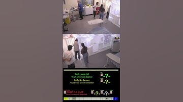 Hepatic Encephalopathy Simulation | Acute Deterioration & Escalation of Care