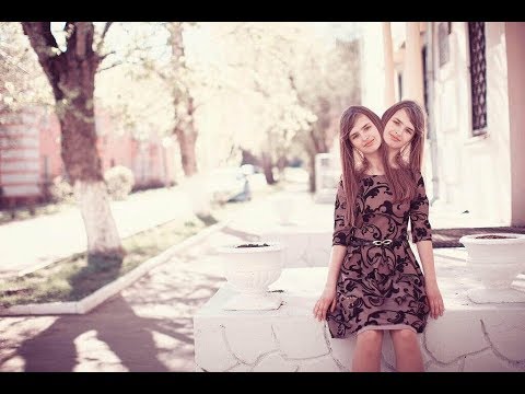 سبحان الله اجمل فتاة براسين Beautiful Girl With Two Heads 