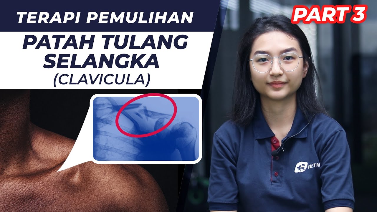 PATAH TULANG SELANGKA, Ini Tips Pemulihannya | Fisioterapi | First Physio