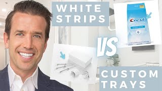 Teeth Whitening | Crest White Strips vs custom bleaching trays