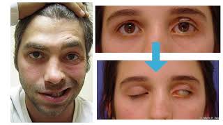 Neurological physical examination THEORY 1