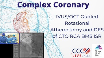 IVUS/OCT Guided Rotational Atherectomy and DES of CTO RCA BMS ISR - June 21st, 2016  Webcast