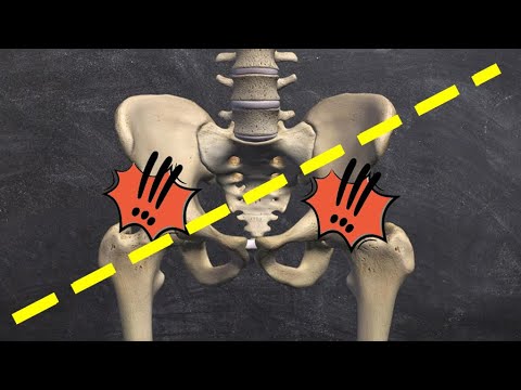 One leg Shorter