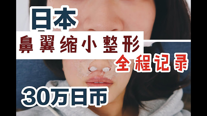 在日本做鼻翼缩小整容手术全过程 超级干货视频 内含手术视频慎入！ - 天天要闻