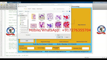 Early Stage Leukemia Blood Cancer Detection Using Matlab | Early Stage Leukemia Classification