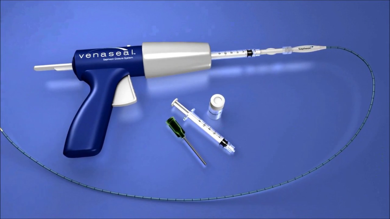 Varicose Veins. The Ultimate Technology "The Glue" YouTube