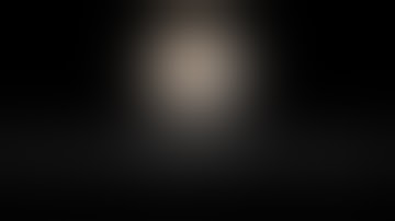 Urine leak after Robotic Partial Nephrectomy management