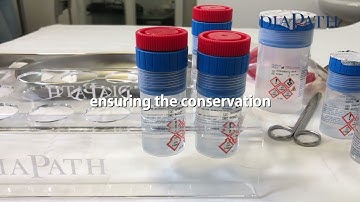 Diapath - SafeCapsule