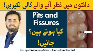 How To Get Rid Of Black Lines On Teeth? | Pits And Fissure Kya Hote Hein? | Daanton Par Kaali Lines