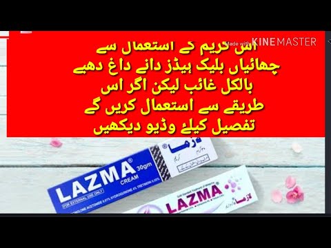 dark spots under eyes during pregnancy Lazma cream uses/benefits and side effects