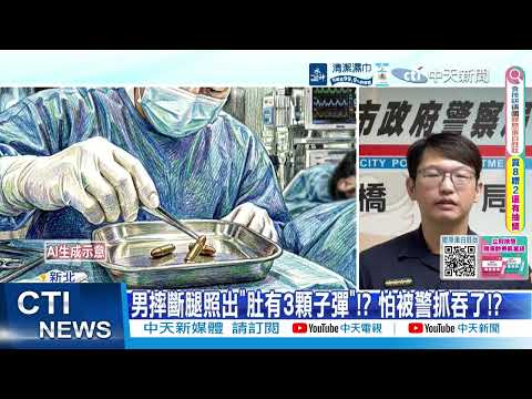 [Daily Must-Watch] Man breaks leg in fall, X-ray reveals "3 bullets in stomach"!? Swallowed them ...