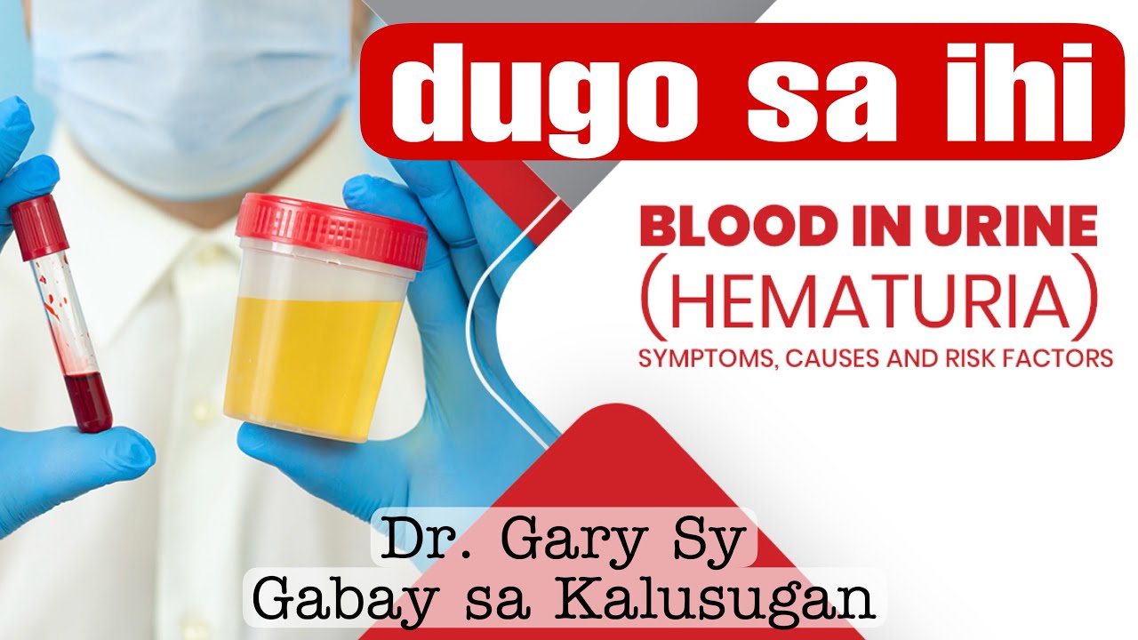 Hematuria: Blood In Urine - Dr. Gary Sy