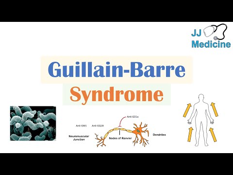 Vidéo: Syndrome De Guillain-Barré: Causes, Symptômes Et Diagnostic