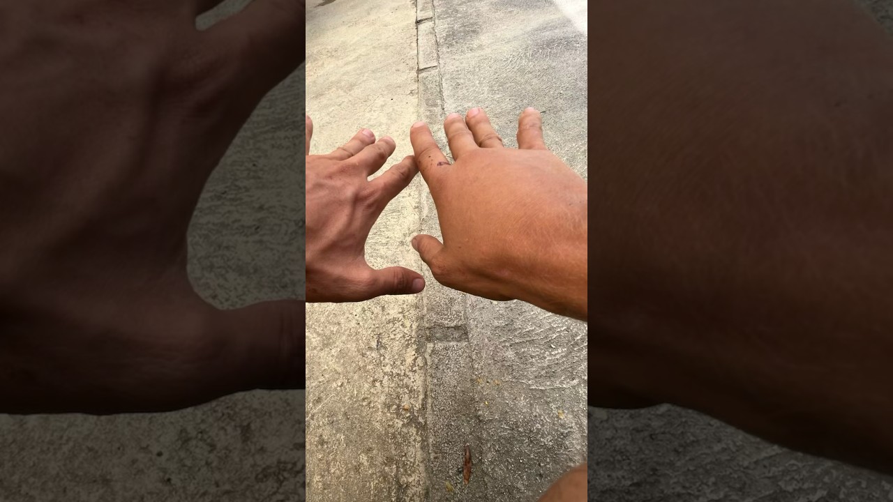 Me mordió una serpiente venenosa… #shorts #animales #serpiente