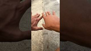 Me mordió una serpiente venenosa… #shorts #animales #serpiente