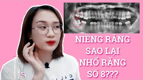 TẠI SAO PHẢI NHỔ RĂNG SỐ 8 KHI CHỈNH NHA