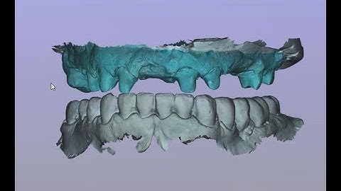 CS 3600 - Maintaining the VDO With Full Arch Case