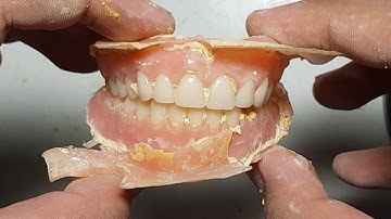 Processing Dentures Part 1 (Flasking, Investing, Wax Elimination, Packing, Curing, Deflasking)