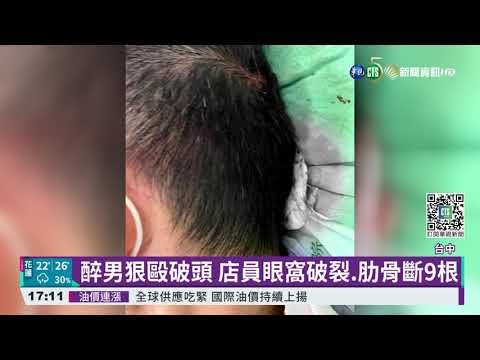 台中超商店員勸客戴罩 遭毆斷9根肋骨｜華視新聞 20211027