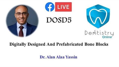 Digitally designed and prefabricated bone blocks: Dr. Alan Alaa Yassin