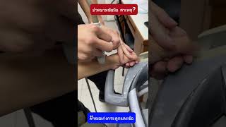 ปวดบวมข้อมือ สาเหตุ? #หมอเก่งกระดูกและข้อ #ปวดข้อมือ #บวม