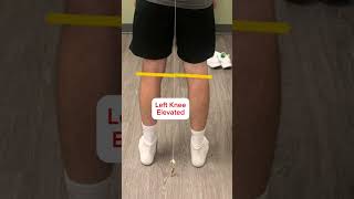Postural Assessment: Posterior View