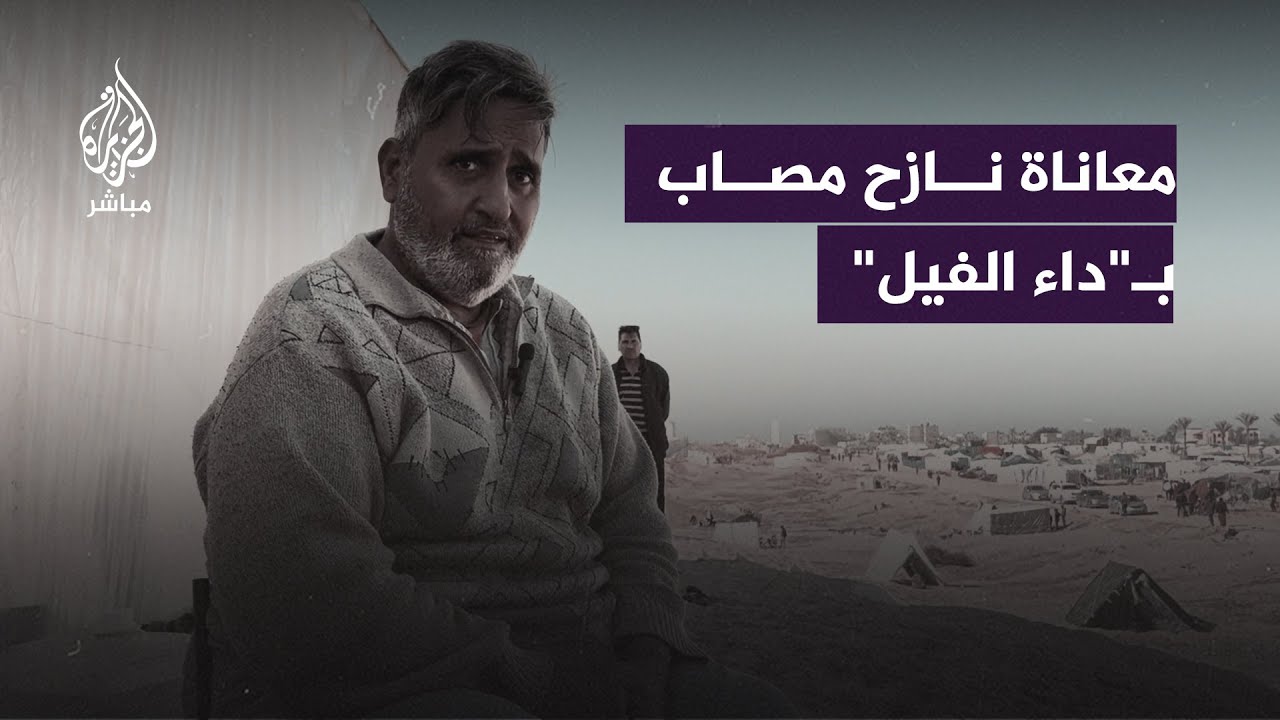 الحصار والحـ.ـرب فاقما معاناته.. نازح فلسطيني يعاني من إصابته بداء الفيل