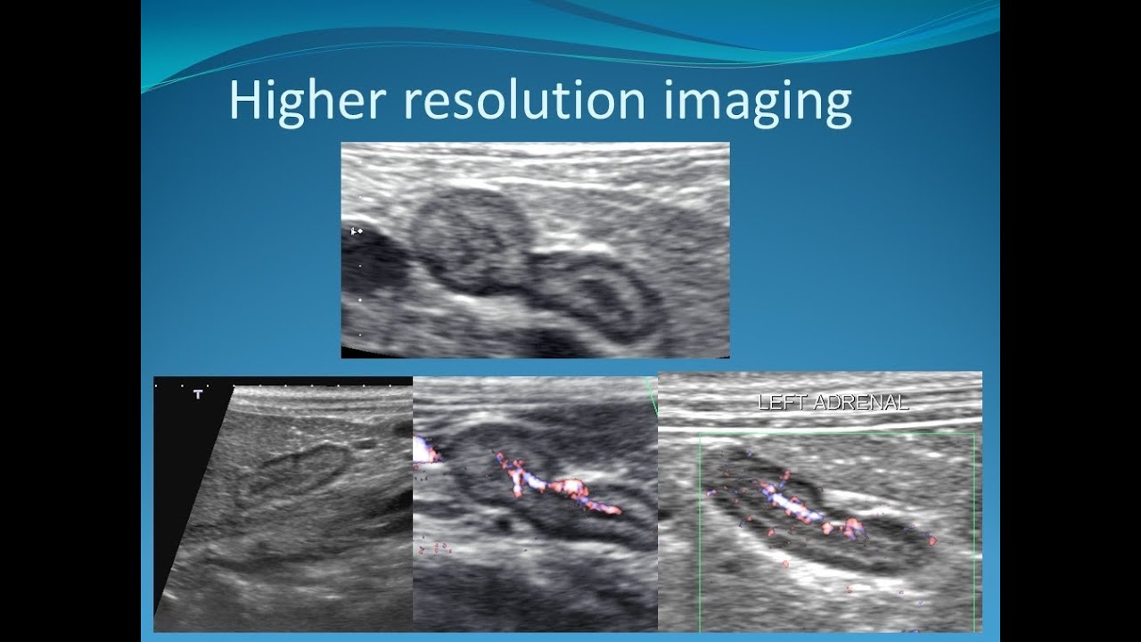 Westbridge canine cushing disease adrenal gland ultrasound