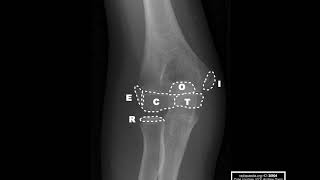 MSK Radiology series - Part 4 screenshot 1
