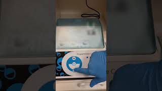 Watch How Amalgam Is Mixed For Dental Fillings