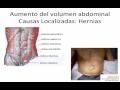 Exámen Físico de abdomen.