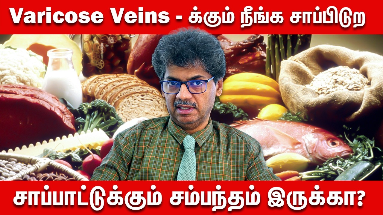 Varicose Veins-க்கும் நீங்க சாப்பிடுற சாப்பாட்டுக்கும் சம்பந்தம் இருக்கா? | Dr. Balakumar